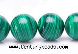 CMA21 15.5 inches 14mm round imitate malachite beads wholesale