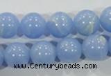 CTU1737 15.5 inches 16mm round synthetic turquoise beads